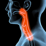 Difficulty swallowing Oropharyngeal dysphagia