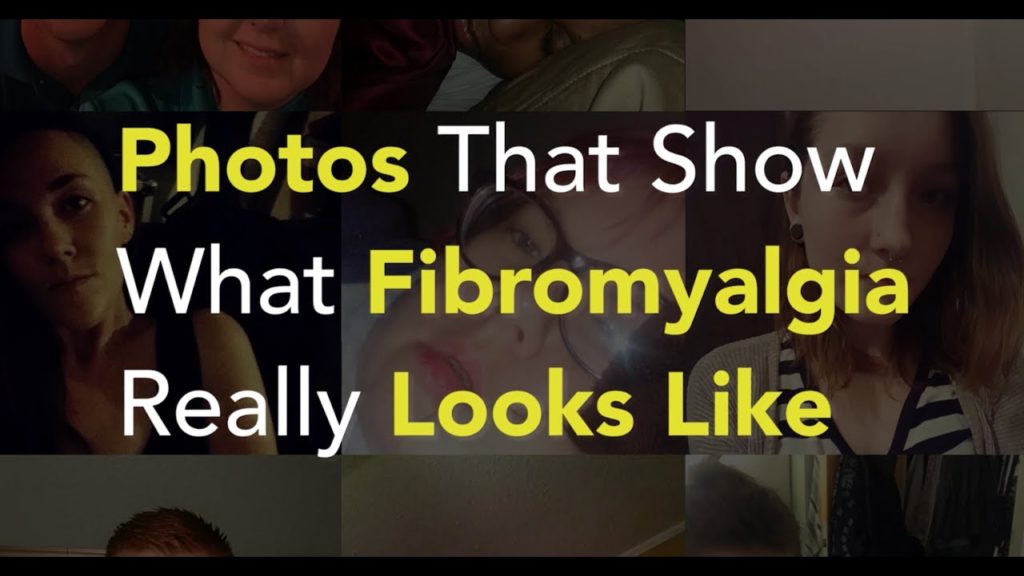 Photos That Show What Fibromyalgia Really Looks Like