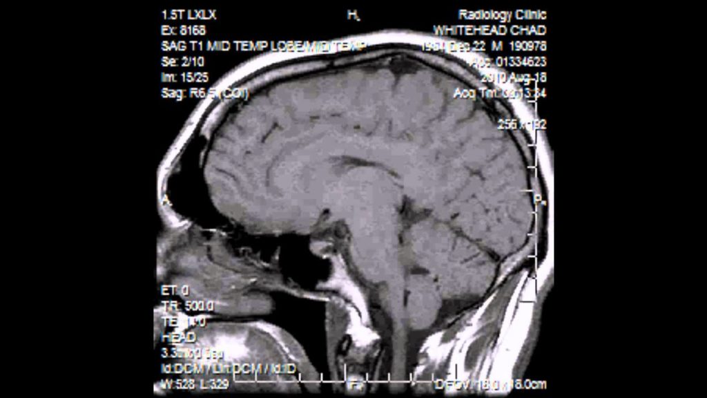 Brain Scan YouTube Capture