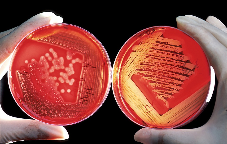 Microbiota transfer therapy for autism: Multi-omic approaches and lessons learned