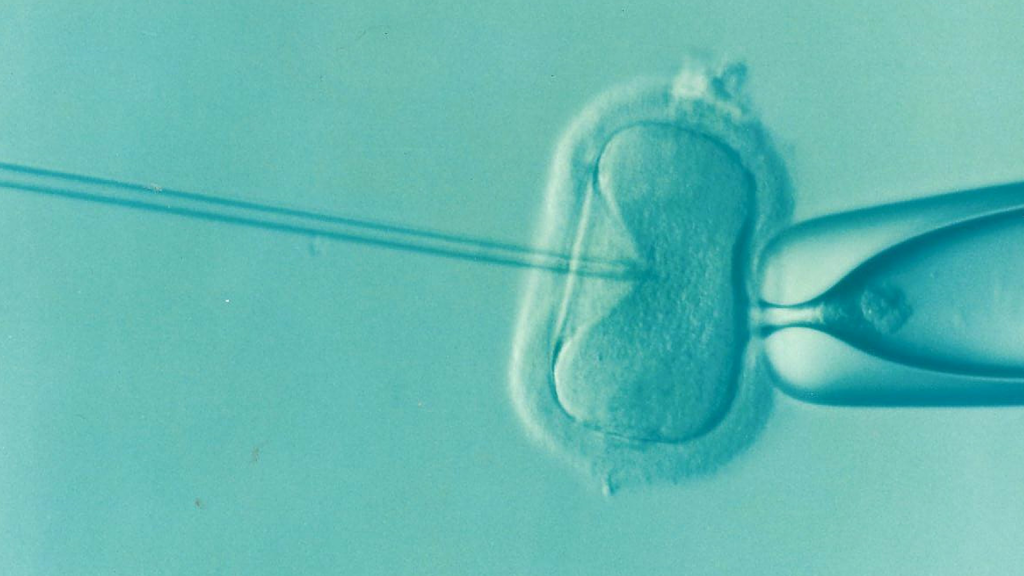 Good news for those with MS—fertility treatments not linked to increase in relapses