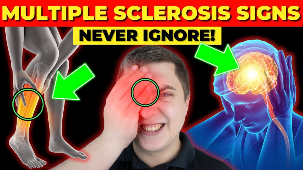 Seven Multiple Sclerosis Symptoms You Should Never Ignore! | Patient Talk